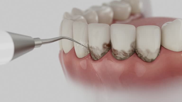 Trusted Tooth Extraction service in Caldwell, TX - Dentist Open Now